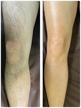 エン(en.)/BeforeAfter写真5