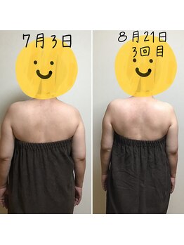 アルディート(Ardito)/肩甲骨剥がし