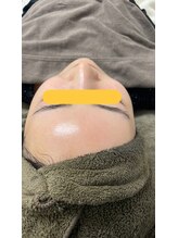 エムアイ 六本木(Mi)/ブライダル前にも☆