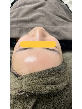 エムアイ 六本木(Mi)/ブライダル前にも☆