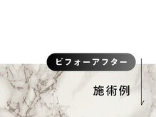 トランザット 六本木店(TransATT)/メンズフェイシャル/ヘッドスパ