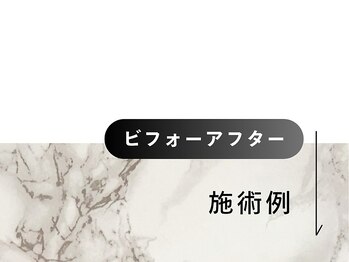 トランザット 六本木店(TransATT)/メンズフェイシャル/ヘッドスパ