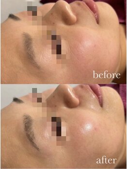 サロン エム(saron M)/お客様ビフォーアフター