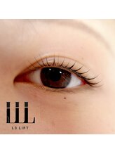 エフ(eFu)/◇施術イメージ◇