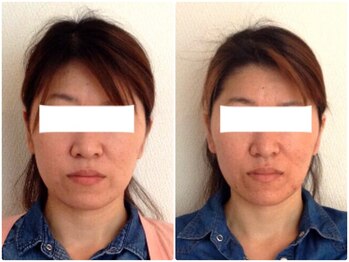 美容整体 ウェリナ 蟹江院/小顔矯正/骨盤矯正/美脚サロン 