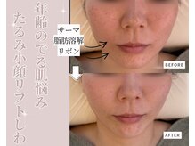 ティパニボーテ(Tipani Beaute')