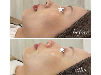 オリエンタル ルボワール(oriental Revoir)/マツヤニホット＆クレイセラピー