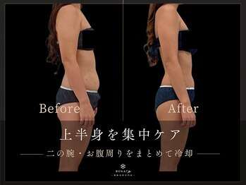 レナータ 新宿店(RENATA)の写真/忙しい大人のための短期集中ボディケア