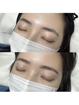 テテ(TeTe)/ハリウッドブロウリフト