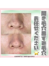 ホワイトアクア 岐阜店(WHITE AQUA)/ハーブピーリング/岐阜/毛穴