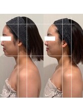 エステティックサロン ラ ベルタ(Esthetic Salon La Belta)/華奢みえコルギ