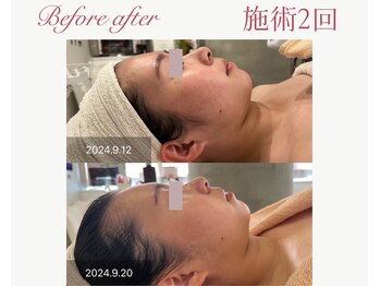 パルタージュ 三宮(Partage)/もたつきさようなら