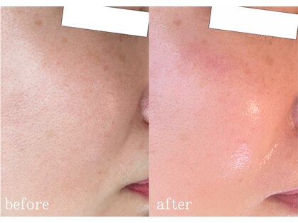 ラポール バイココイロ(rapport by COCOIRO)の写真