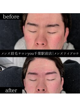 ユー 千葉駅前店(you)/ビフォ－アフター写真