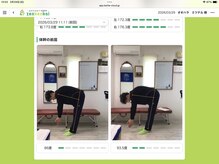 ボンド(BOND)/AIで施術後の可動域を可視化！