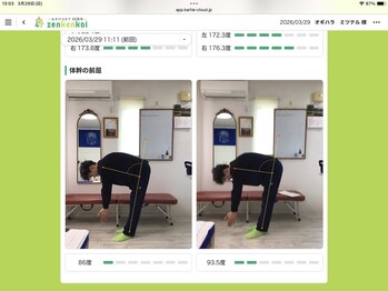 ボンド(BOND)/AIで施術後の可動域を可視化！