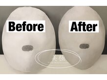 美極 トータルビューティー(美極 TOTAL BEAUTY)/恵比寿/小顔コルギ/エステ/