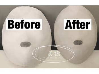 美極 トータルビューティー(美極 TOTAL BEAUTY)/恵比寿/小顔コルギ/エステ/