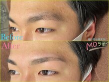エムディラボ 金沢竪町店(MDラボ)/BeforeAfter