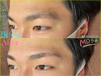 エムディラボ 金沢竪町店(MDラボ)/BeforeAfter