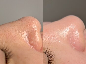 ルーナジェーナ(Luna llena)/池袋　エステ　ルーナジェーナ