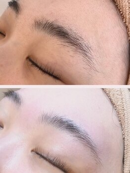エリス(ELISSE)の写真/【肌悩みに効果あり☆】フェイシャルワックス+超保湿超鎮静生パックの極上仕上げでお悩み解決、プルプル肌!