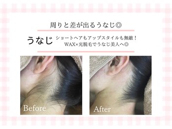 アルゴ 熊本宇土店(ALGO)/【うなじ】WAX人気パーツ☆