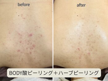 ヴェールココン(Veil Cocon)/