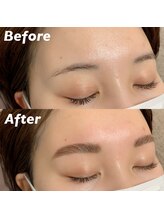 キンキー 広島(kinky)/