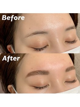 キンキー 広島(kinky)/