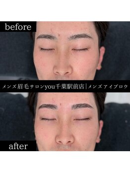 ユー 千葉駅前店(you)/ビフォ－アフター写真