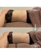 東京デトックス/美くびれビフォアフ