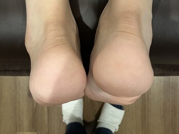 ミチ(Michi)/Before