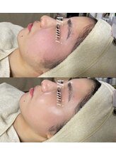 ミーミドットアイ(Mi-mi.i)/艶肌フェイシャルワックス