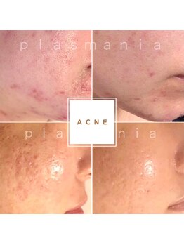 キュレイテッドスキン(CURATED SKIN)の写真/【国家資格保持】本気の肌質改善*効果のレベルが他とは違う◆くすみ/毛穴/ニキビケアで素肌レベル引き上げ!