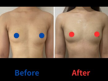 ポインセチア(Poinsettia)/ダイナミックバスト4DX/並び比較