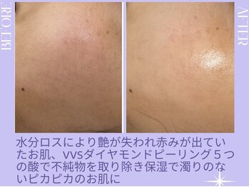 リラクゼーションサロン ラキ(laki)/スキンメイド/トロイアルケ