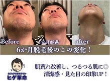 ヒゲ革命 難波日本橋