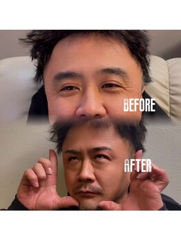 アルセ(Arce.)/しっかり生えてる事が大事