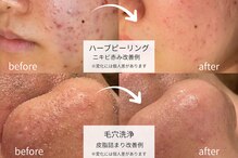 ザ リノビューティー 横浜店(THE Lino Beauty)