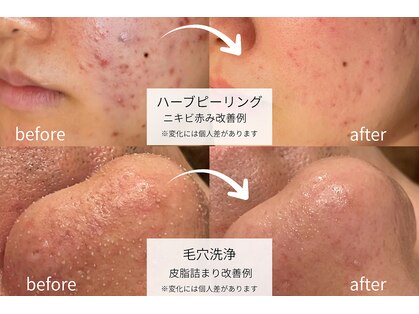 ザ リノビューティー 横浜店(THE Lino Beauty)の写真