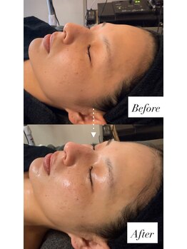 ジスドット(JISOO.)の写真/【韓国肌管理】憧れのノーファンデを目指せる◎ 肌の根本からケアして肌質改善に◎憧れのすっぴん美肌へ♪