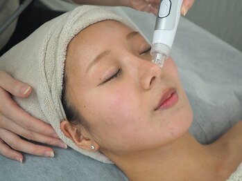 ライム 錦糸町(LIME)の写真/《黒ずみ/ブツブツ/頑固な角栓もごっそり除去》毛穴洗浄¥8000～皮脂や汚れが原因のニキビケアも◎