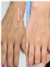 ★横浜上陸SNS話題★ララピンク【ハンド】通常¥135,000→2回¥19,800