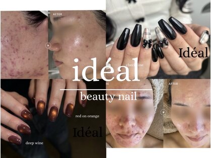 イデアル(Ideal)の写真
