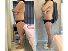 アールエイチビー 藤沢店(RHB)/【30代】1回での変化☆