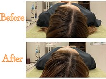 あさひ整体院 日本橋浜町院/美背中ストレッチ