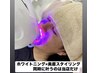 ホワイトニングご新規様◎【眉毛×ホワイトニング】同時施術で時短♪¥5,000