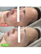 ルルーディア(LOULOUDIA)/肌育フェイシャルで美白へ♪