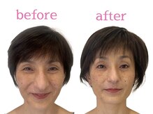 ナチュラルセラピー ドロップ(Drop)